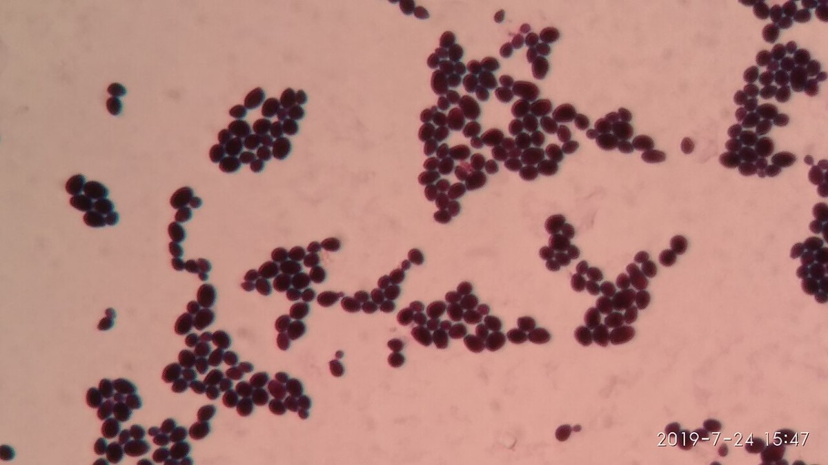 Cellule di Candida albicans colorate con Gram e osservate al microscopio