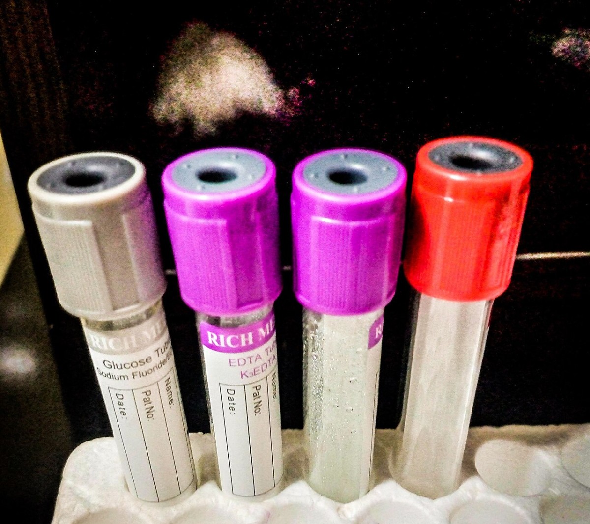 Provette per esami del sangue in un laboratorio di analisi