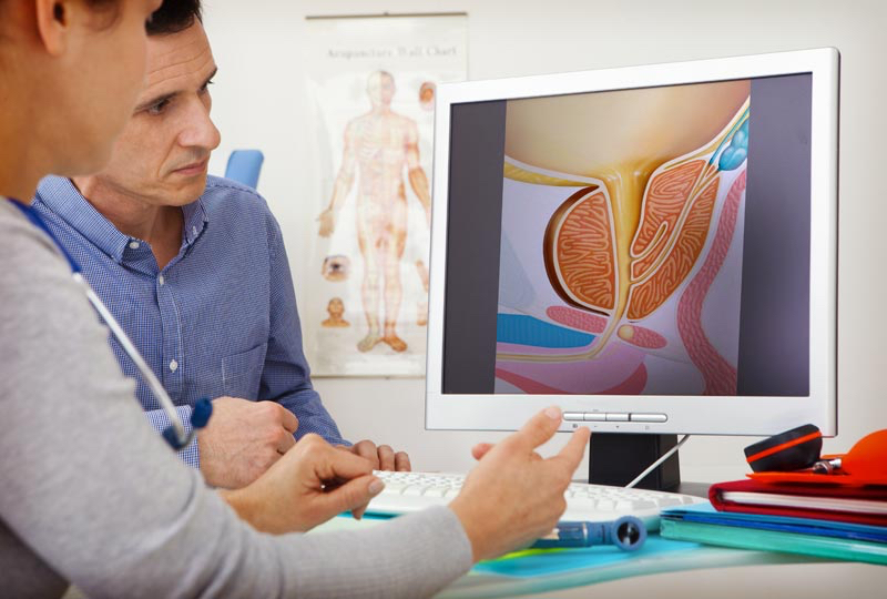Il Dr. Felice Romano illustra al paziente l'anatomia della prostata
