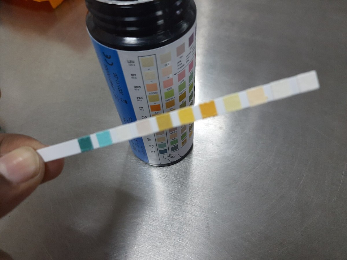 Stick reattivo per l'esame delle urine accanto al flacone con la scala colorimetrica